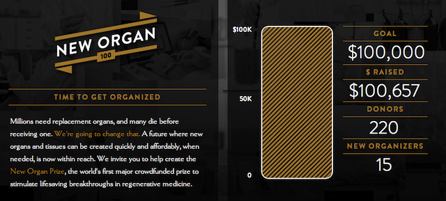 NewOrgan1